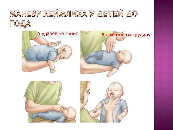 5 ударов по спине 5 нажатий на грудину 