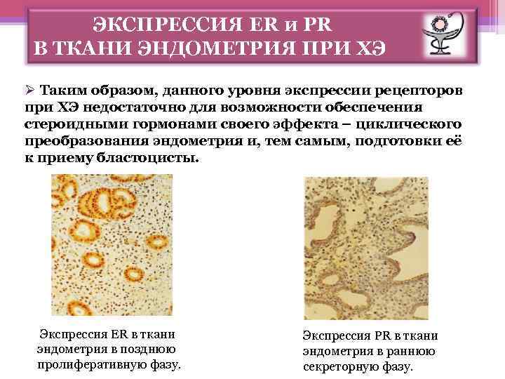 ЭКСПРЕССИЯ ER и PR В ТКАНИ ЭНДОМЕТРИЯ ПРИ ХЭ Ø Таким образом, данного уровня