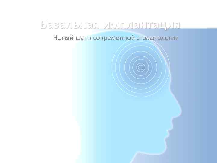  Базальная имплантация Новый шаг в современной стоматологии 