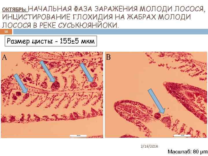 ОКТЯБРЬ: НАЧАЛЬНАЯ ФАЗА ЗАРАЖЕНИЯ МОЛОДИ ЛОСОСЯ, ИНЦИСТИРОВАНИЕ ГЛОХИДИЯ НА ЖАБРАХ МОЛОДИ ЛОСОСЯ В РЕКЕ