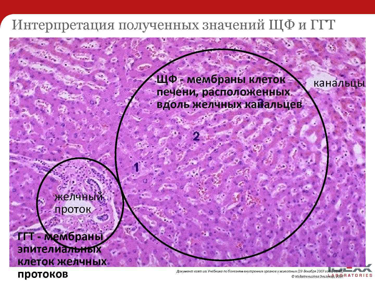 Интерпретация полученных значений ЩФ и ГГТ ЩФ - мембраны клеток канальцы печени, расположенных вдоль