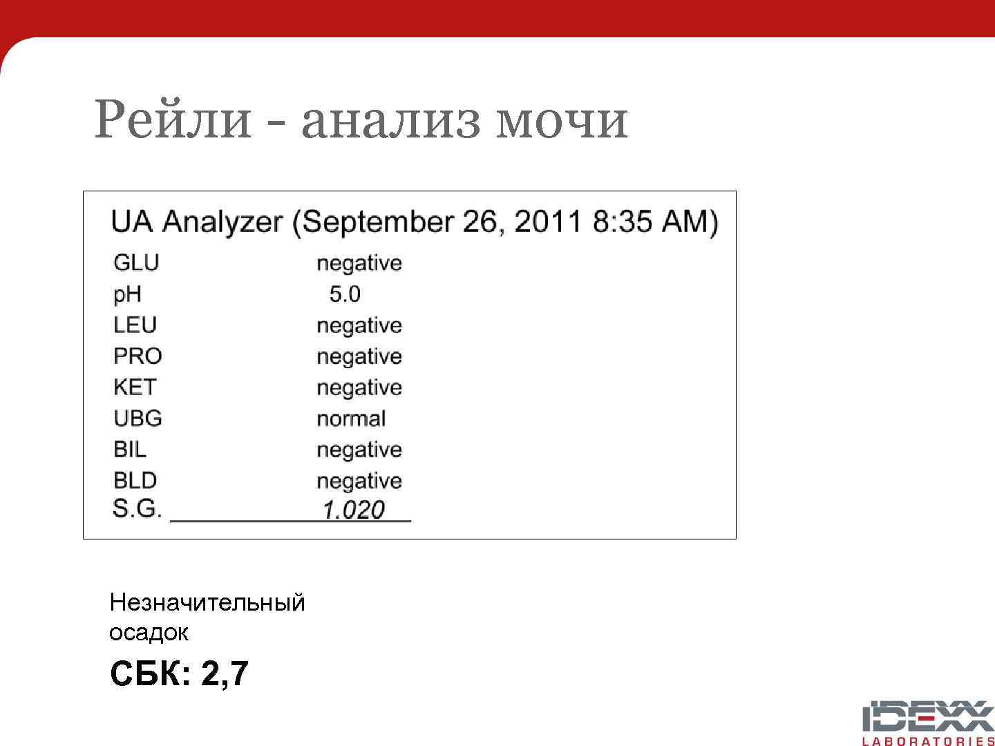 Рейли - анализ мочи Незначительный осадок СБК: 2, 7 