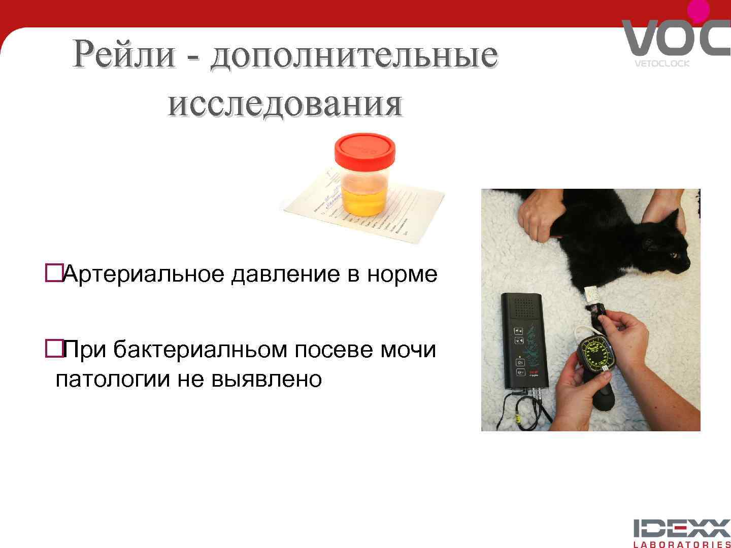 Рейли - дополнительные исследования Артериальное давление в норме При бактериалньом посеве мочи патологии не