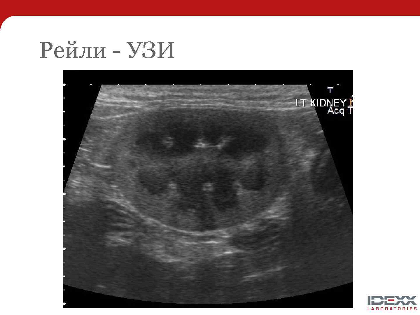 Рейли - УЗИ 