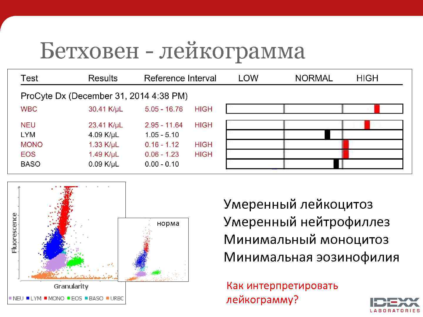 Бетховен - лейкограмма норма Умеренный лейкоцитоз Умеренный нейтрофиллез Минимальный моноцитоз Минимальная эозинофилия Как интерпретировать