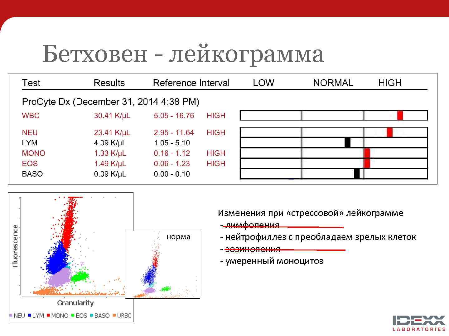 Бетховен - лейкограмма норма Изменения при «стрессовой» лейкограмме - лимфопения - нейтрофиллез с преобладаем
