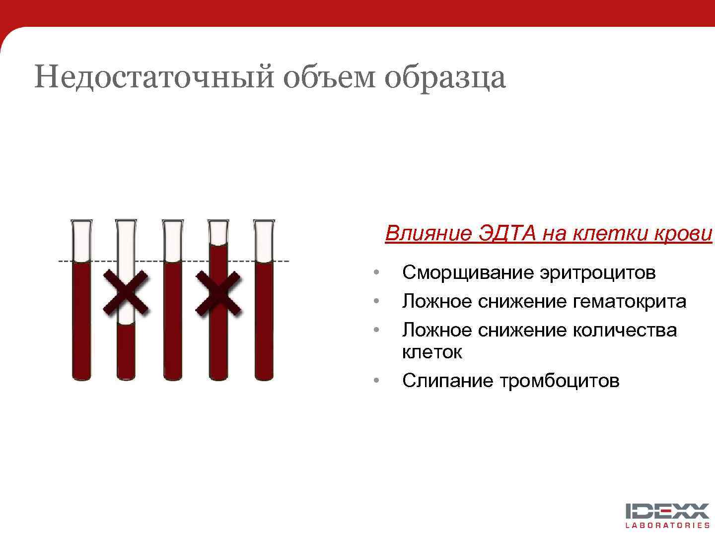 Недостаточный объем образца Влияние ЭДТА на клетки крови • • Сморщивание эритроцитов Ложное снижение