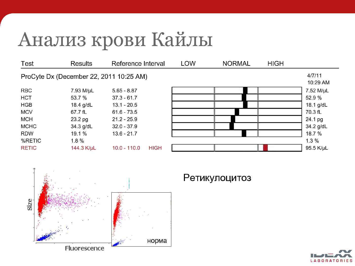 Анализ крови Кайлы Ретикулоцитоз норма 