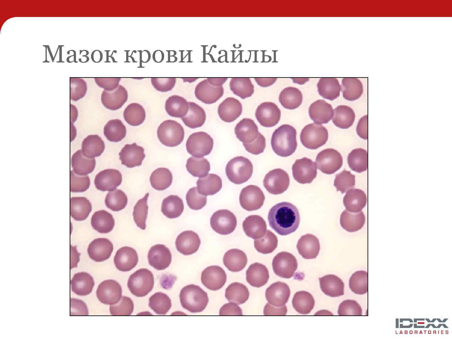 Мазок крови Кайлы 