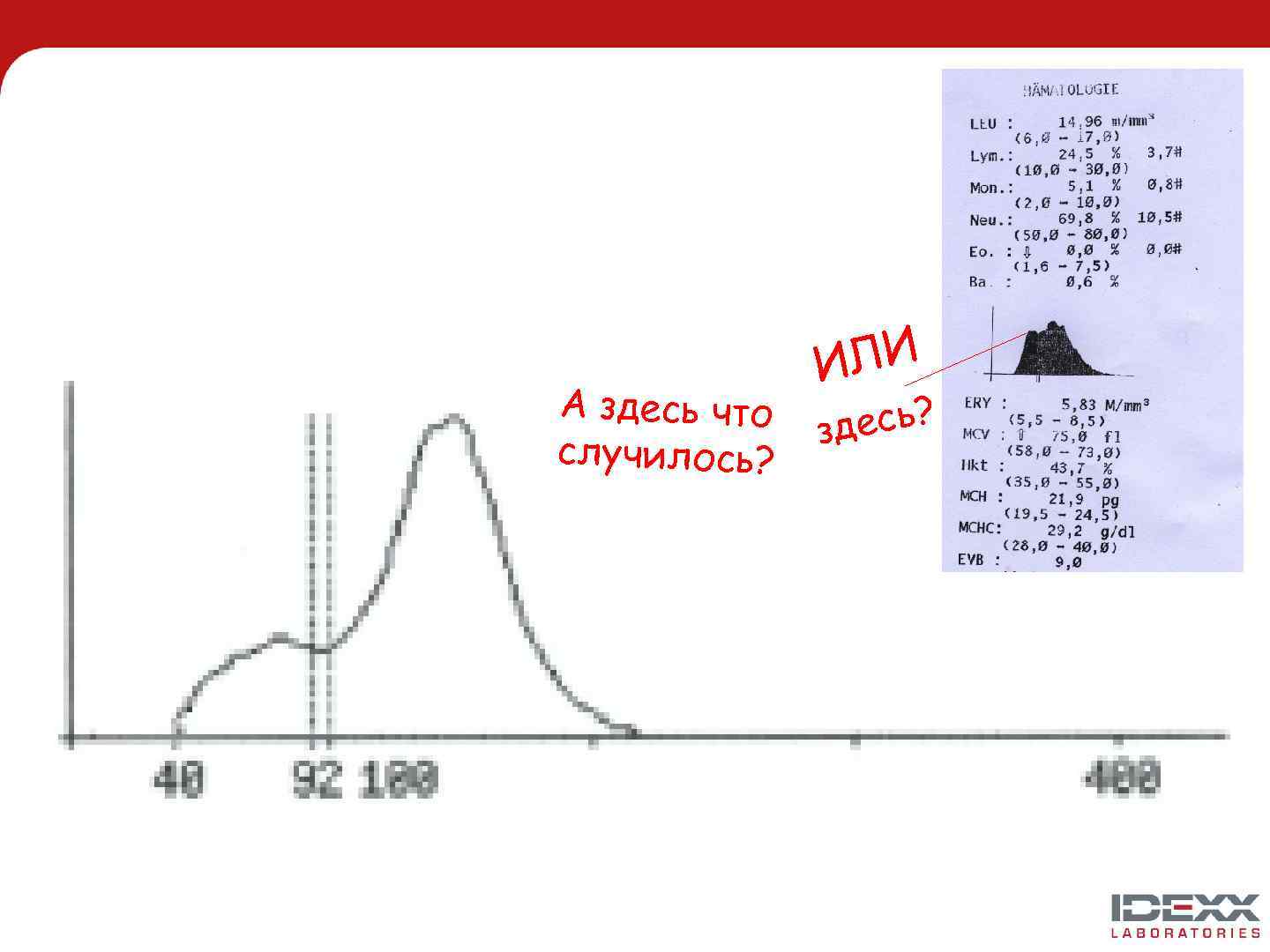 А здесь что случилось? ЛИ И есь? зд 