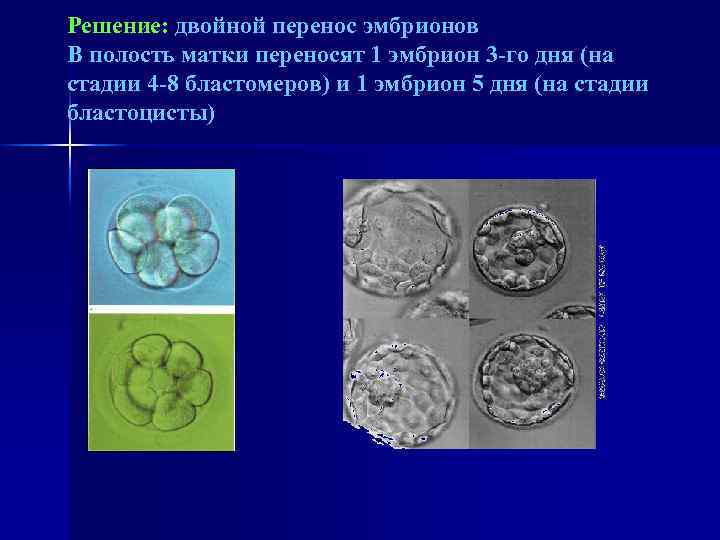 Перенос эмбриона 5