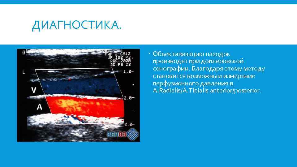 ДИАГНОСТИКА. Объективизацию находок производят при доплеровской сонографии. Благодаря этому методу становится возможным измерение перфузионного