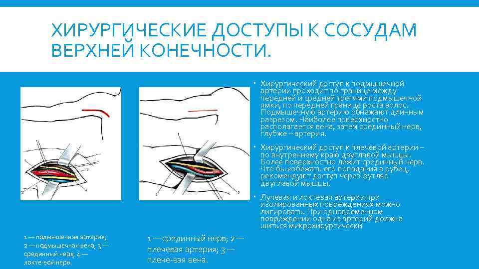 ХИРУРГИЧЕСКИЕ ДОСТУПЫ К СОСУДАМ ВЕРХНЕЙ КОНЕЧНОСТИ. Хирургический доступ к подмышечной артерии проходит по границе