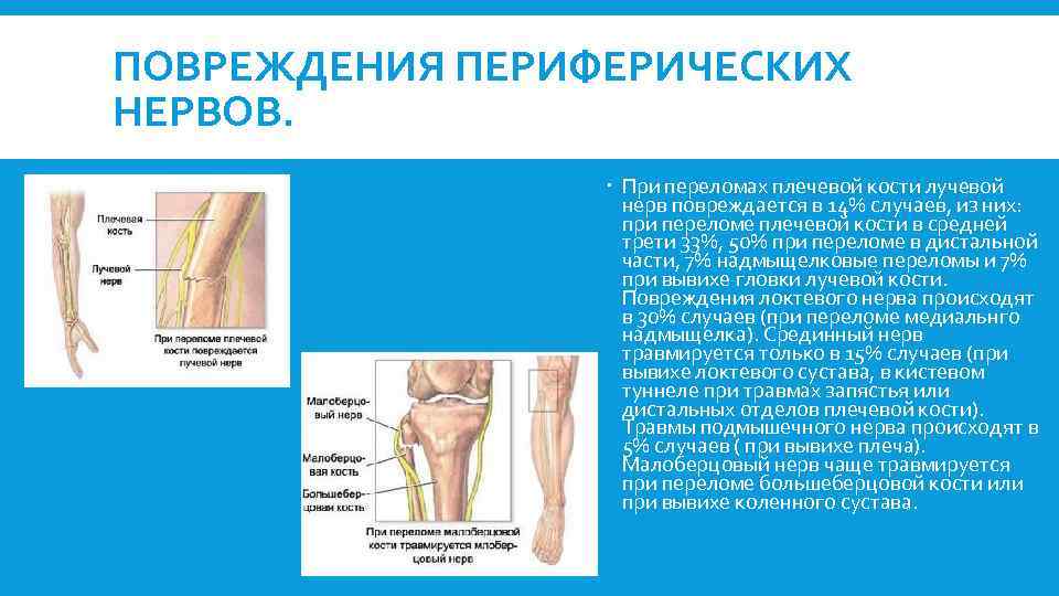 ПОВРЕЖДЕНИЯ ПЕРИФЕРИЧЕСКИХ НЕРВОВ. При переломах плечевой кости лучевой нерв повреждается в 14% случаев, из