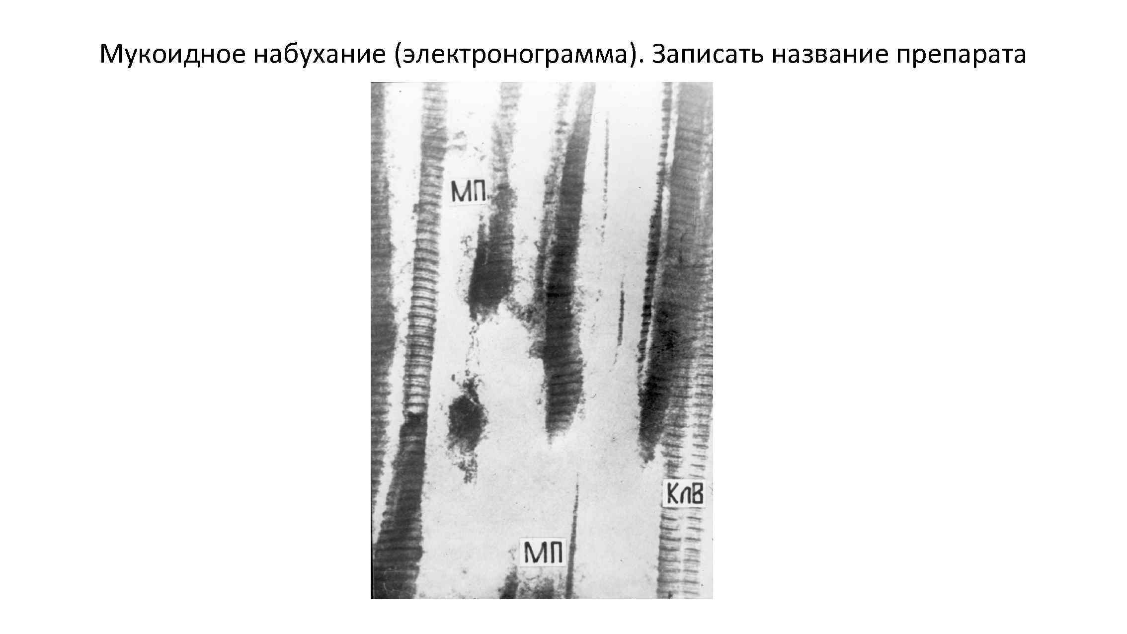 Мукоидное набухание (электронограмма). Записать название препарата 
