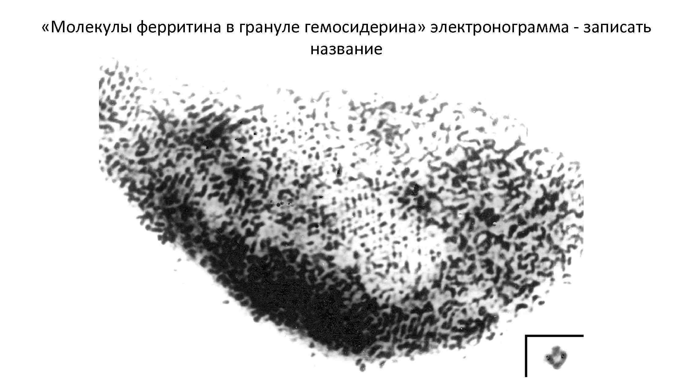  «Молекулы ферритина в грануле гемосидерина» электронограмма - записать название 