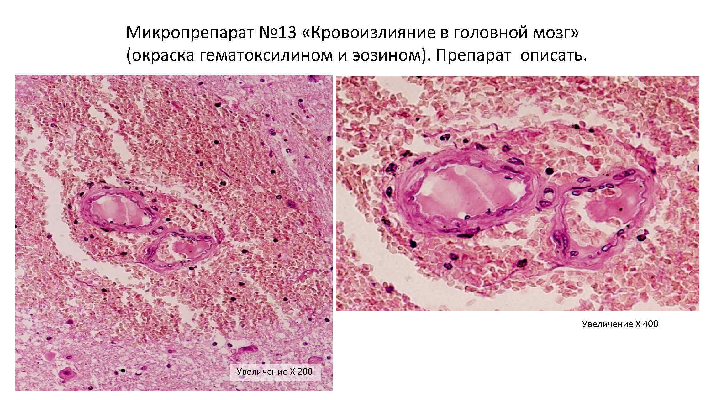 Саговая селезенка микропрепарат рисунок