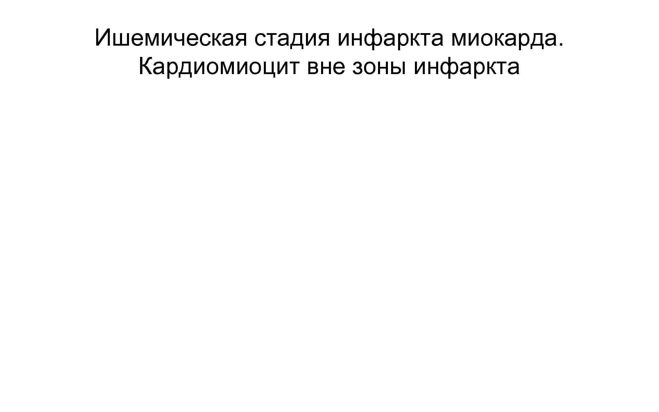 Ишемическая стадия инфаркта миокарда. Кардиомиоцит вне зоны инфаркта 