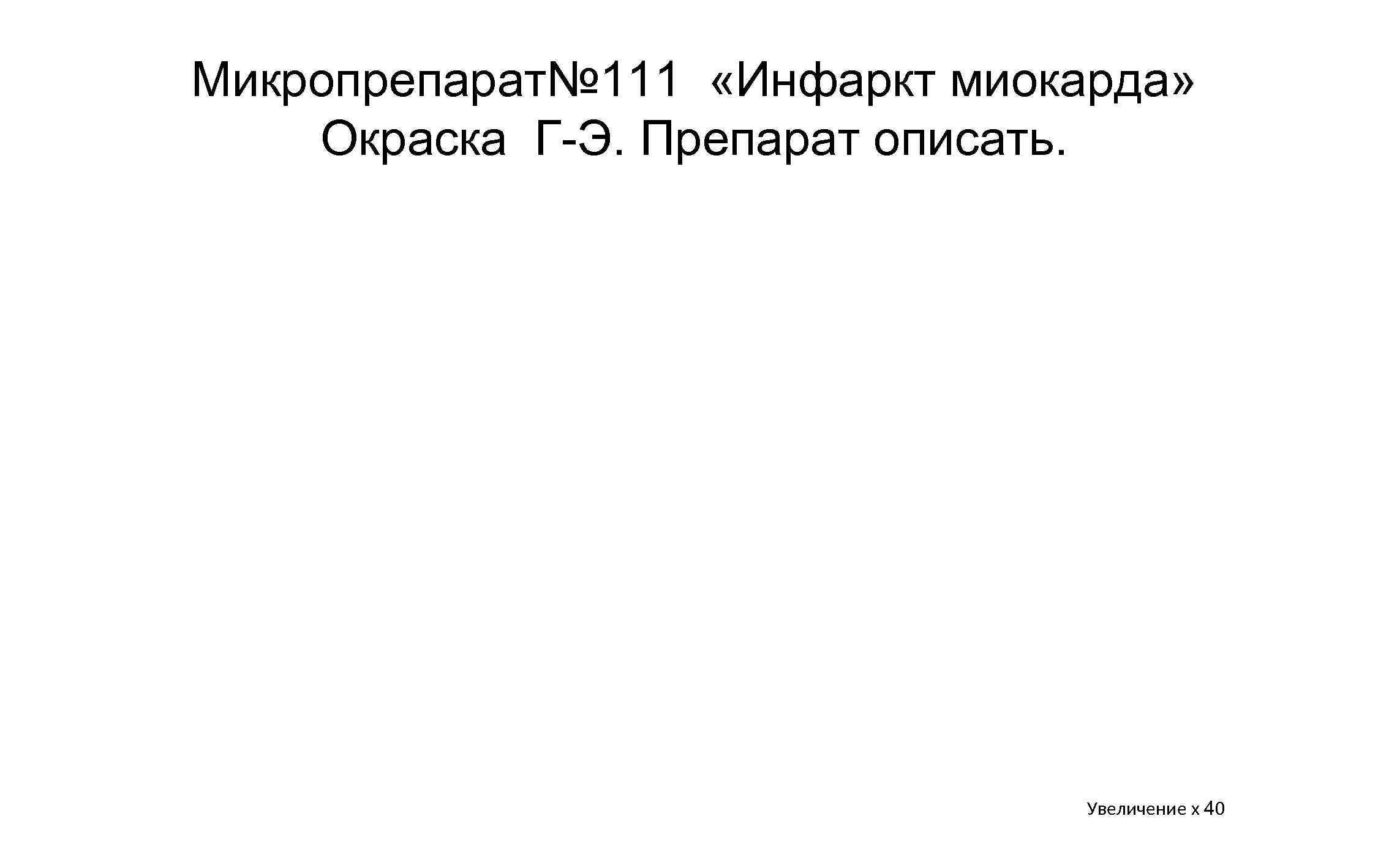 Микропрепарат№ 111 «Инфаркт миокарда» Окраска Г Э. Препарат описать. Увеличение х 40 