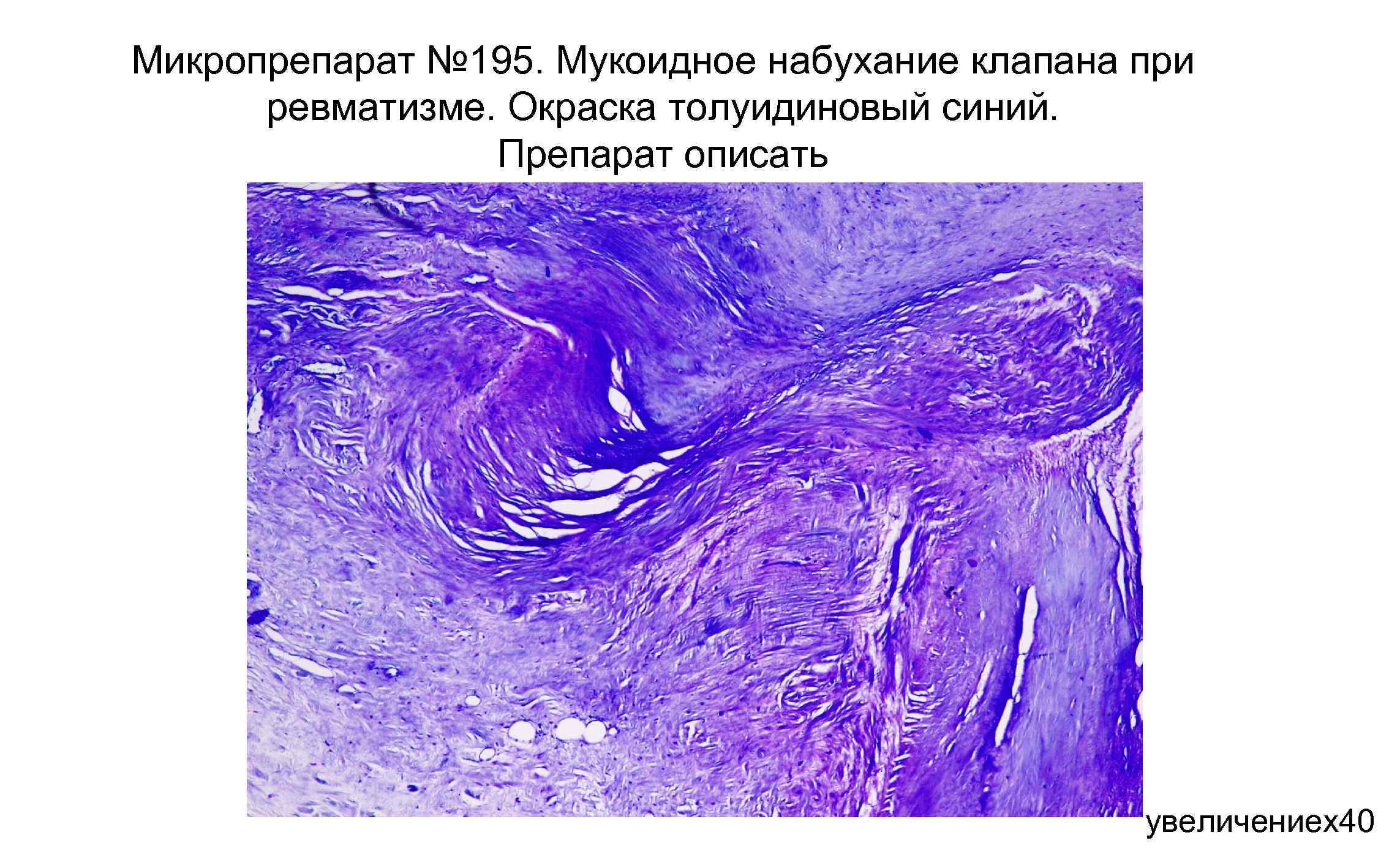 Митральный клапан гистология рисунок