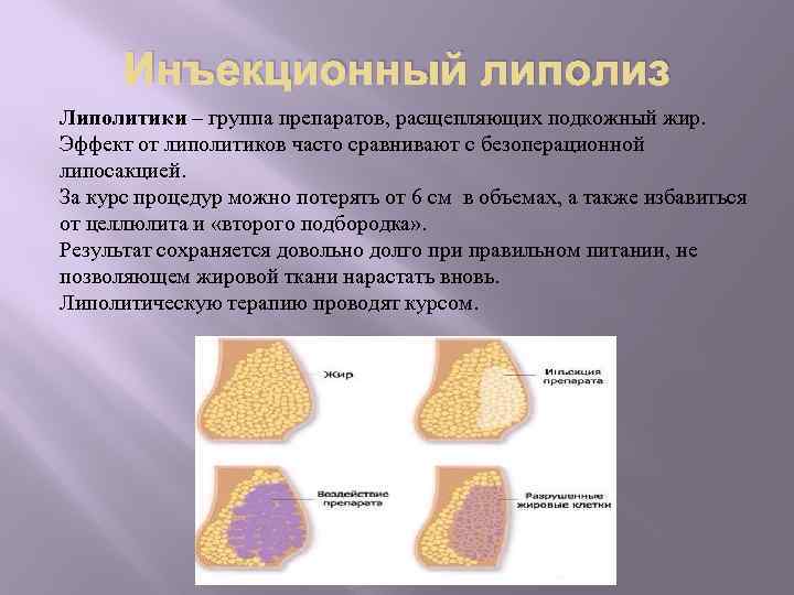 Инъекционный липолиз Липолитики – группа препаратов, расщепляющих подкожный жир. Эффект от липолитиков часто сравнивают