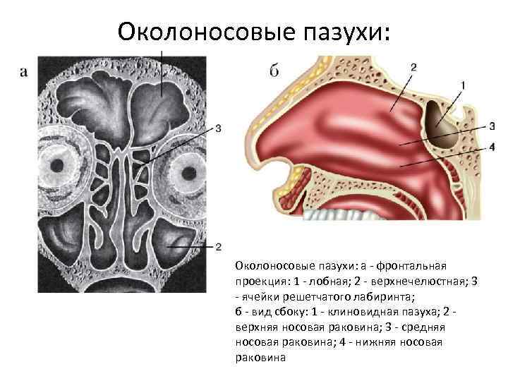 Околоносовые пазухи: а - фронтальная проекция: 1 - лобная; 2 - верхнечелюстная; 3 -