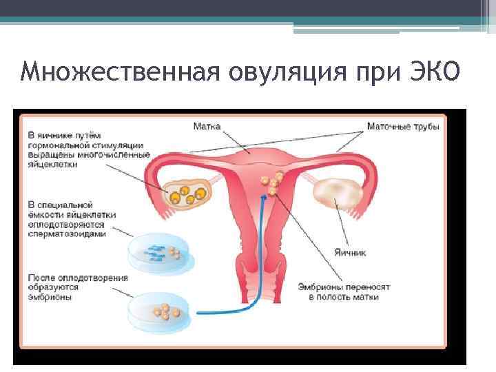 Множественная овуляция при ЭКО 