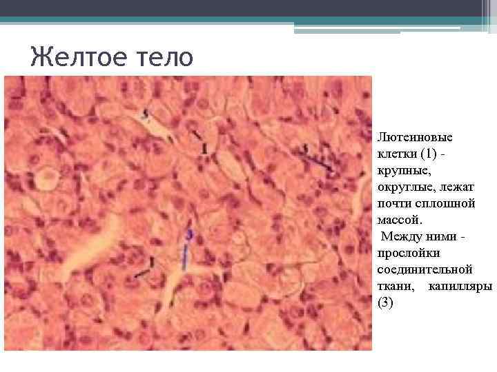 Желтое тело Лютеиновые клетки (1) крупные, округлые, лежат почти сплошной массой. Между ними прослойки