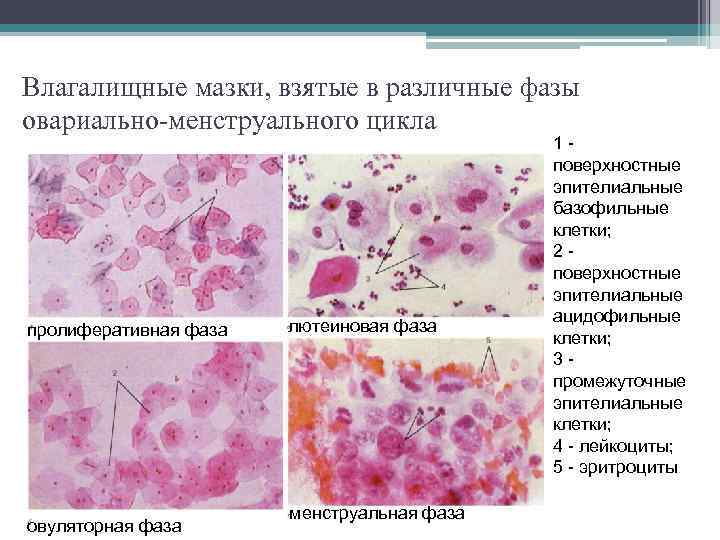 Влагалищные мазки, взятые в различные фазы овариально-менструального цикла пролиферативная фаза овуляторная фаза лютеиновая фаза