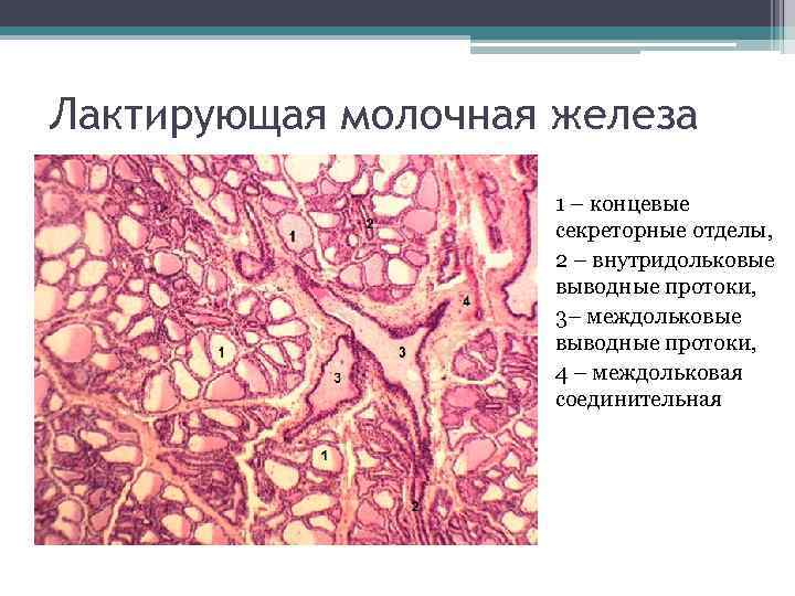 Лактирующая молочная железа 1 – концевые секреторные отделы, 2 – внутридольковые выводные протоки, 3–