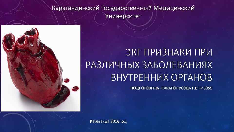 Карагандинский Государственный Медицинский Университет ЭКГ ПРИЗНАКИ ПРИ РАЗЛИЧНЫХ ЗАБОЛЕВАНИЯХ ВНУТРЕННИХ ОРГАНОВ ПОДГОТОВИЛА: КАРАГОНУСОВА Г.