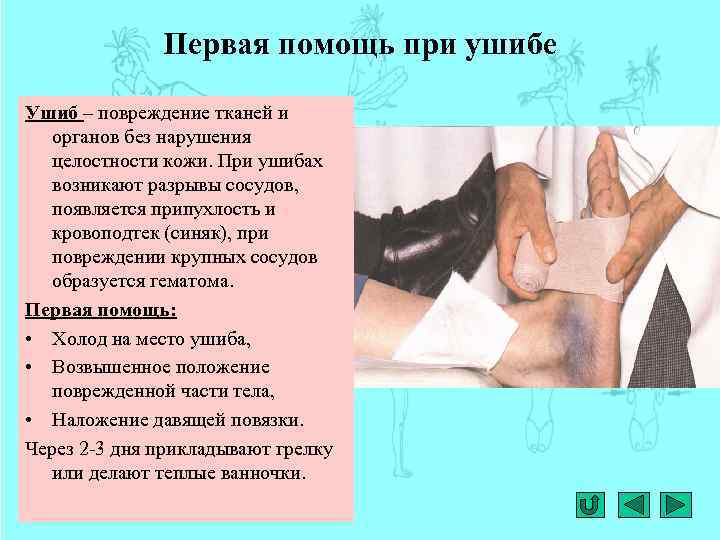 Первая помощь при ушибе Ушиб – повреждение тканей и органов без нарушения целостности кожи.