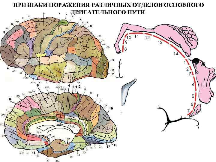 Поражение двигательного анализатора на различных уровнях поражения схема