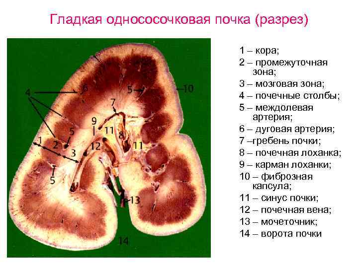 Гладкая однососочковая почка (разрез) 1 – кора; 2 – промежуточная зона; 3 – мозговая