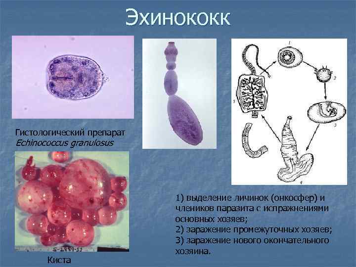 Эхинококк Гистологический препарат Echinococcus granulosus Киста 1) выделение личинок (онкосфер) и члеников паразита с