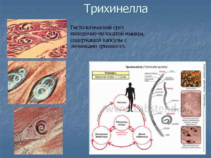 Трихинелла личинка в мышцах рисунок