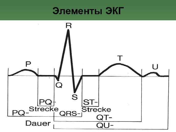 Элементы ЭКГ 