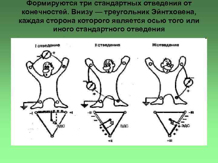 Формируются три стандартных отведения от конечностей. Внизу — треугольник Эйнтховена, каждая сторона которого является