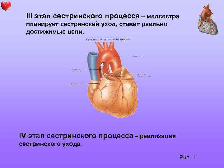 III этап сестринского процесса – медсестра планирует сестринский уход, ставит реально достижимые цели. IV