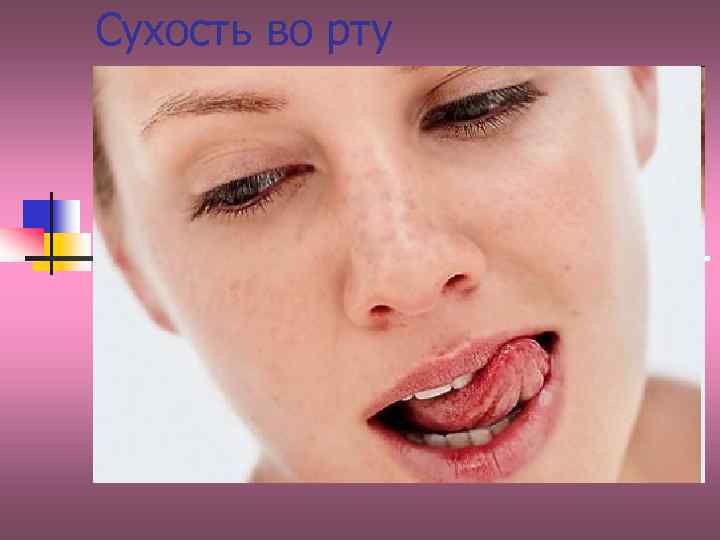 Сухость во рту 