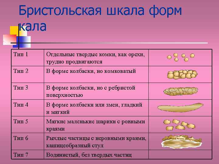 Бристольская шкала форм кала Тип 1 Отдельные твердые комки, как орехи, трудно продвигаются Тип