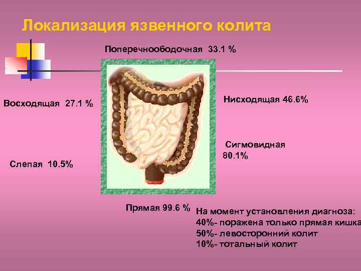 Локализация язвенного колита Поперечноободочная 33. 1 % Восходящая 27. 1 % Слепая 10. 5%
