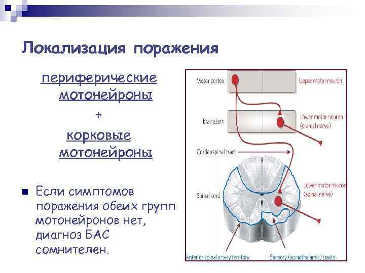 Локализация поражения периферические мотонейроны + корковые мотонейроны n Если симптомов поражения обеих групп мотонейронов