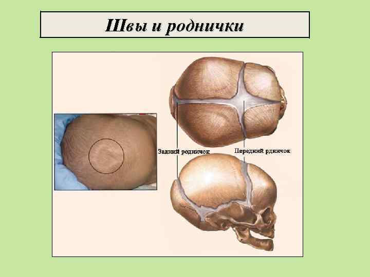 Швы и роднички 