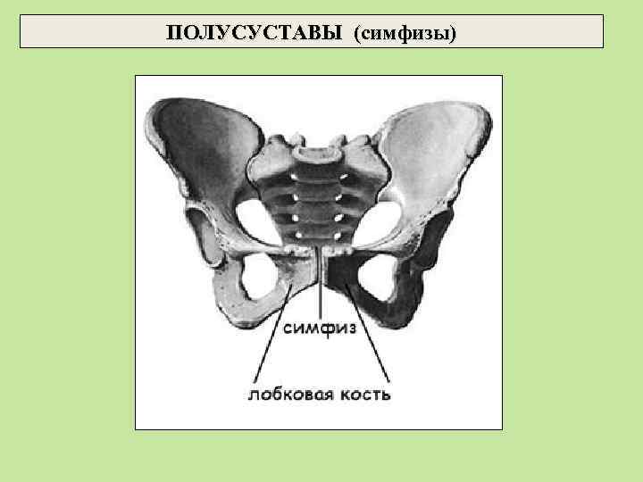 ПОЛУСУСТАВЫ (симфизы) 