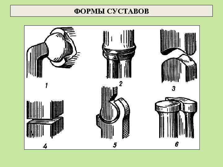ФОРМЫ СУСТАВОВ 