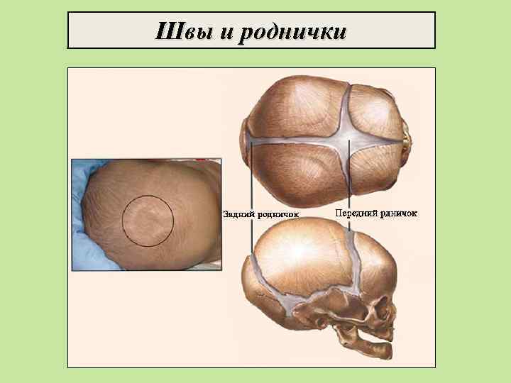 Швы и роднички 