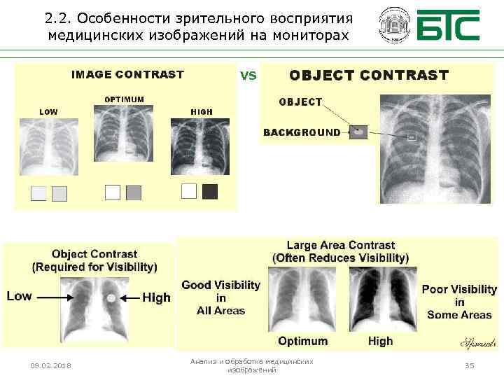 2. 2. Особенности зрительного восприятия медицинских изображений на мониторах VS 09. 02. 2018 Анализ