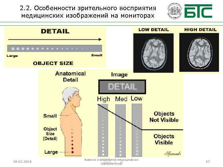 2. 2. Особенности зрительного восприятия медицинских изображений на мониторах 09. 02. 2018 Анализ и