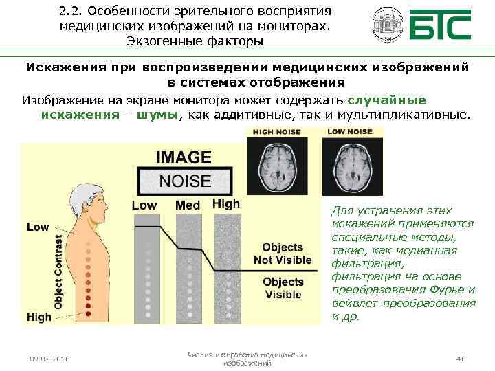 2. 2. Особенности зрительного восприятия медицинских изображений на мониторах. Экзогенные факторы Искажения при воспроизведении